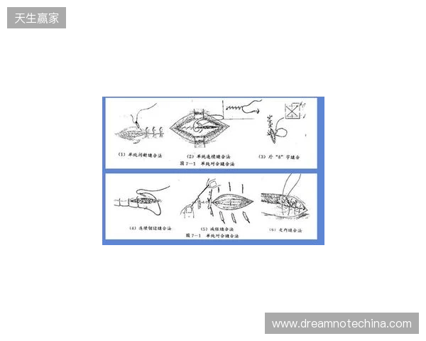 广州豹官方:杨浩眉弓伤口缝合30余针,预计5-7天后拆线 广州豹官方:杨浩眉弓伤口缝合30余针,预计5-7天后拆线